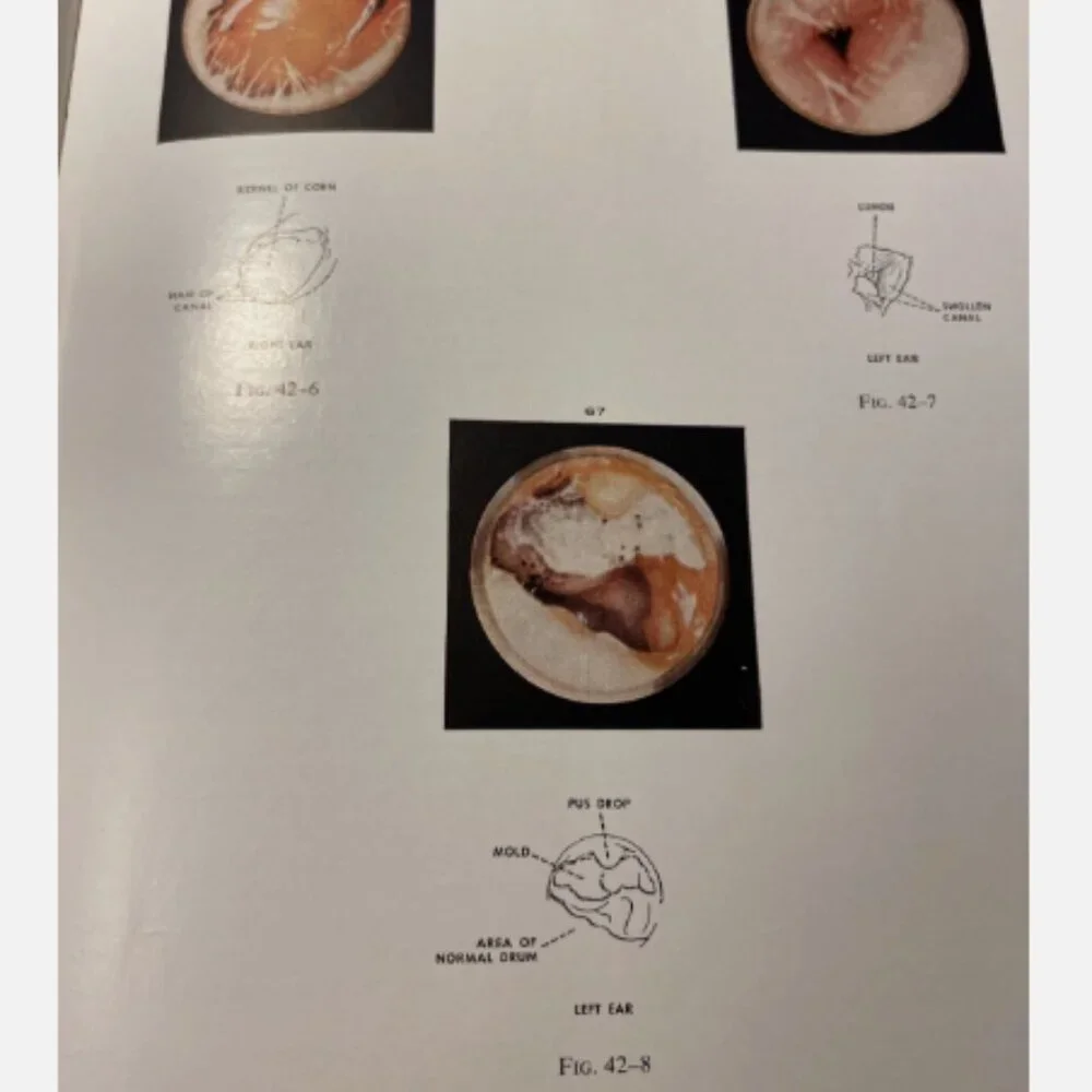 Diseases Of The Nose Throat And Ear 11th Ed John Jacob Ballenger